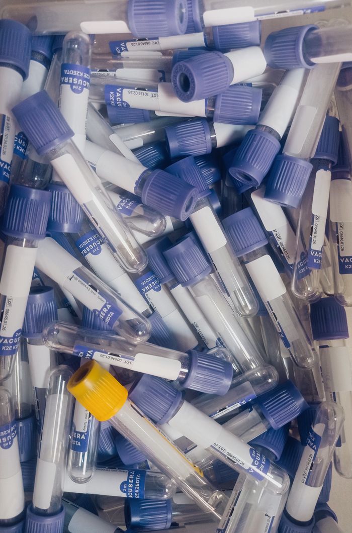 Close-up of assorted blue and yellow cap laboratory test tubes, ideal for medical stock photos.