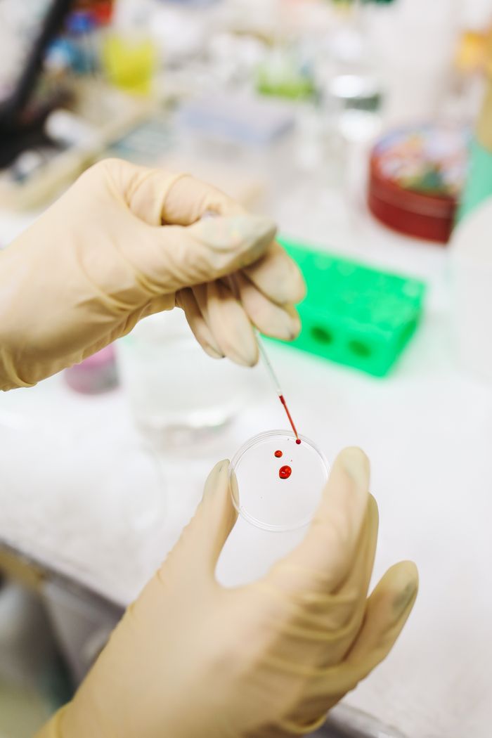 Close-up of a scientist's hands in gloves analyzing a blood sample in a laboratory setting.
