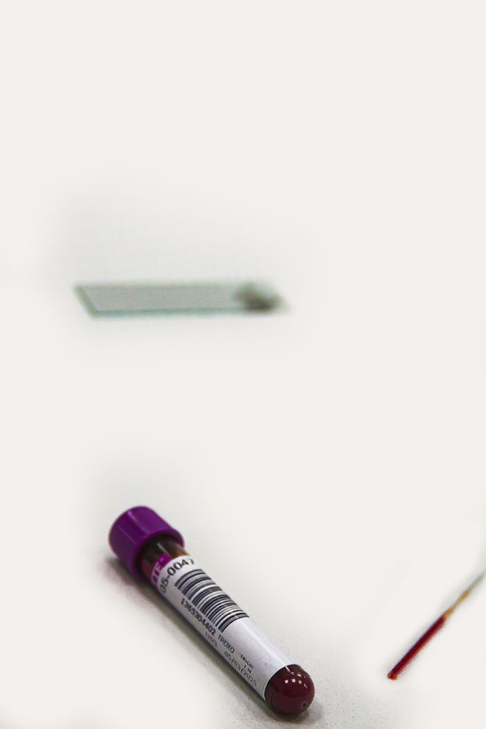 Blood vacutainer with sample and slide on a white background for medical testing.