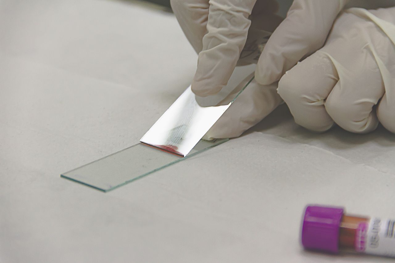 about-us Scientist in gloves preparing a glass slide with a sample for microscopic analysis.