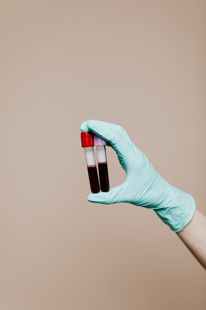Mastering the First Impression: Your intriguing post title goes here Close-up of a gloved hand holding test tubes with blood samples against a neutral background.