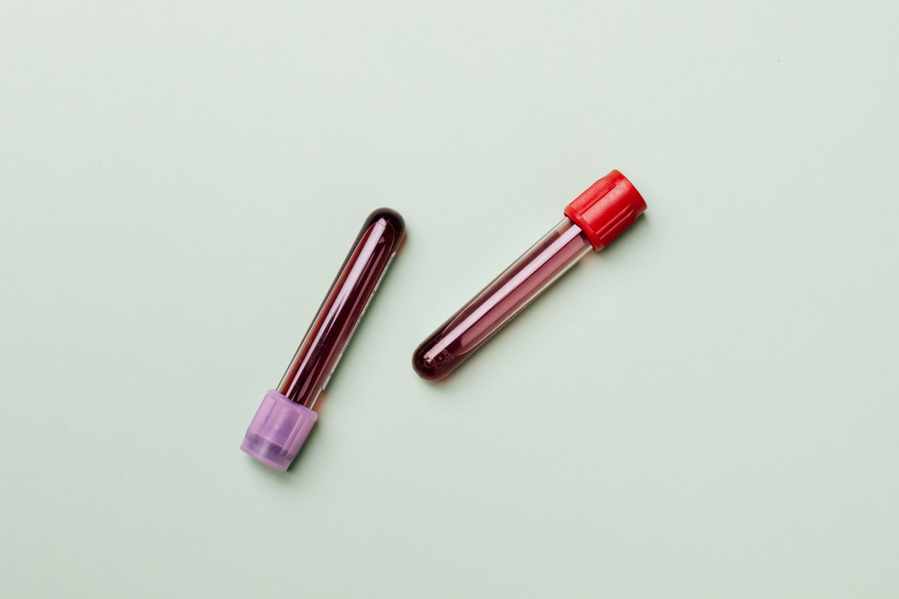 get-in-touch Blood samples in test tubes on a light background, ideal for medical and laboratory themes.