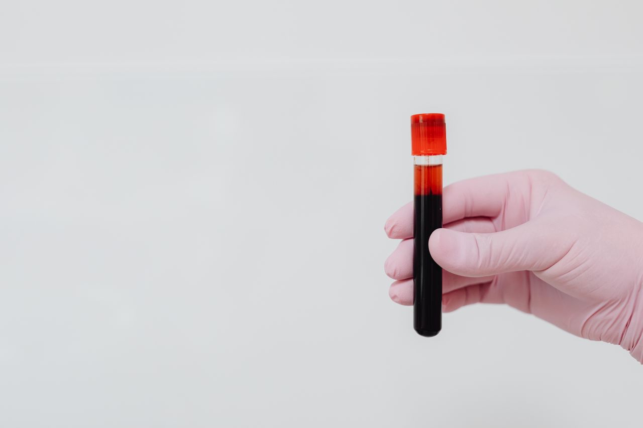 Crafting Captivating Headlines: Your awesome post title goes here A gloved hand holding a blood sample in a test tube with a white background.