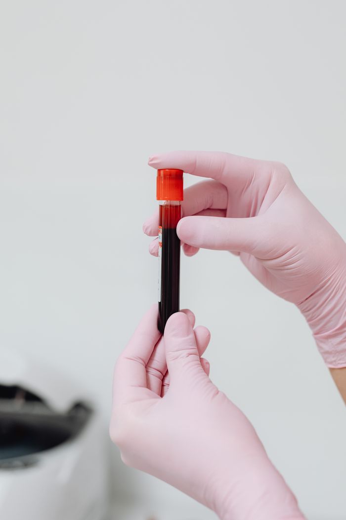 The Art of Drawing Readers In: Your attractive post title goes here Close-up of gloved hands holding a blood test tube with red liquid against a white background.