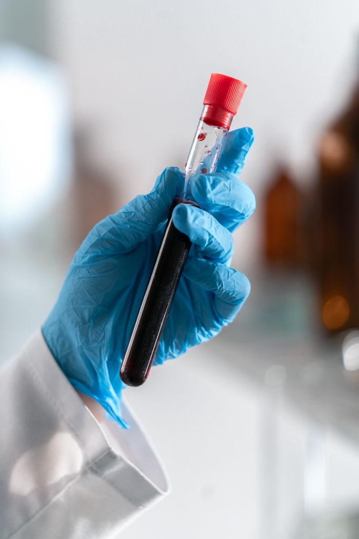 our-story Close-up of a gloved hand holding a blood sample in a laboratory setting.